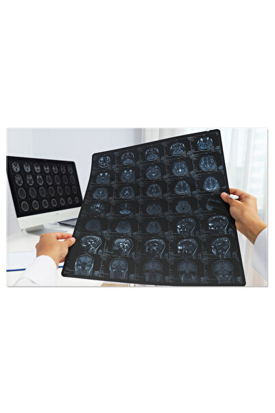 StoryGift Romania Tablou Canvas - Analiza Prin Radiologie: Clinic, Mri, Medic...