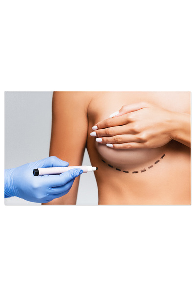 StoryGift Romania Tablou Canvas: Perfectionare Estetica, Chirurgie, Intervent...