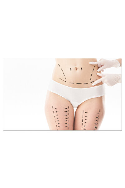 StoryGift Romania Tablou Canvas - Interventie Chirurgicala Estetica, Liniile ...