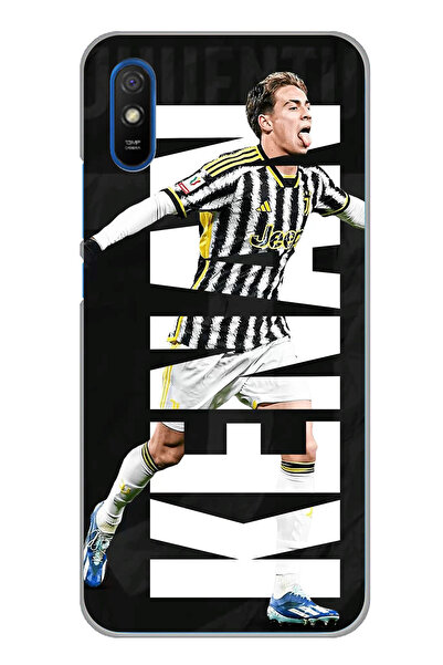 TechTree Redmi 9A Uyumlu Kenan Yıldız Sevinç Şeffaf Silikon Kılıf