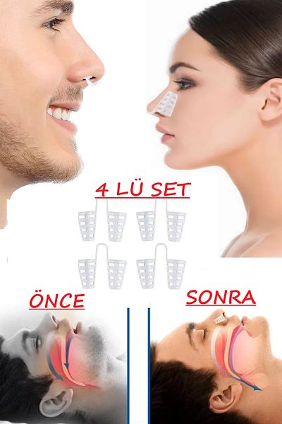 optana Comfortable Breathing Comfortable Sleep Anti-Snoring Reducing Nasal Hole Apparatus Apnea Apparatus