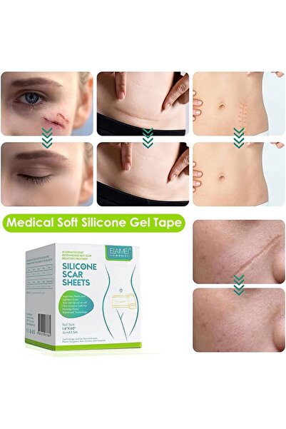 Tayarra Silicone Scar Roll, Medical Silicone Scar Remover Sheet, Waterproof Silicone Scar Sheet