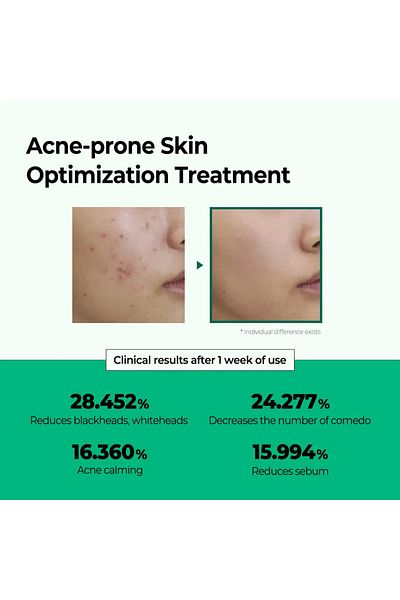 Some By Mi Miracle AC Clear Spot Treatment - 10ml