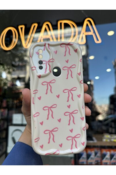 OVADA OPPO A31 Uyumlu Kamera Korumalı Dalgalı Kenarlı Kalp ve Kurdele Baskılı...
