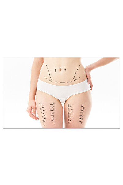 StoryGift Romania Tablou Canvas Cu Chirurgie Cosmetica - Redescoperirea Frumu...