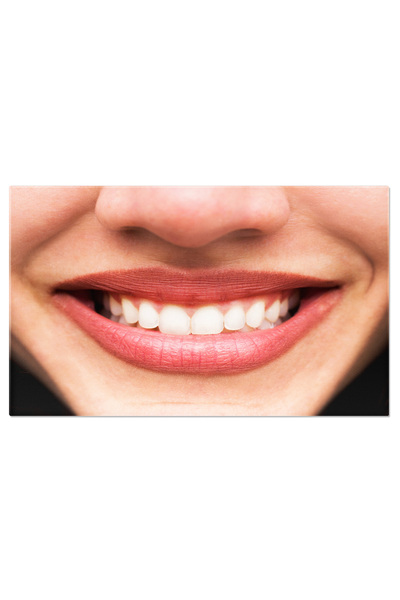 StoryGift Romania Tablou Canvas - Zambet Perfect: Portretul Elegantei Dentare