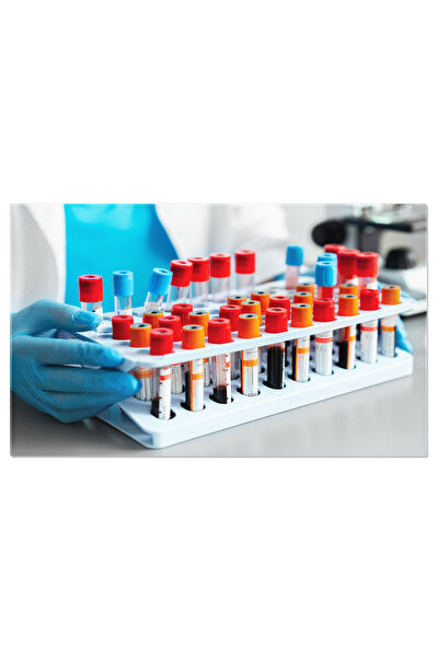 StoryGift Romania Tablou Canvas: Analize Medicale Si Echipamente De Laborator: Sanatate Si Teste