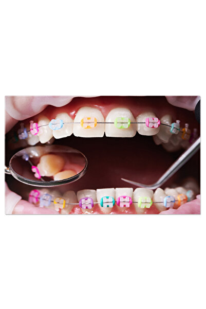 StoryGift Romania Tablou Canvas - Zambet Perfect: Bratari Dentare Si Ingrijire Orala