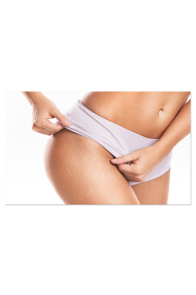 StoryGift Romania Tablou Canvas - Frumusete Fara Imperfectiuni