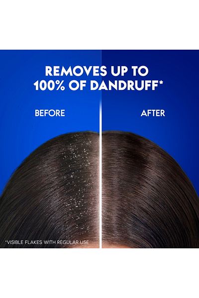 Head&Shoulders Head & Shoulders Smooth & Silky 2 in 1 Anti-Dandruff Shampoo with Conditioner 600 ml