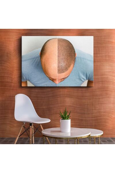 Şehzat Tekli Yatay Saç Ekimi Uzmanı - Saç Yoğunluğu Artırma Dekoratif Kanvas ...