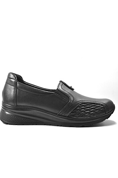 Beety Справжня шкіра Чорні ортопедичні жіночі туфлі з подвійним кістковим виступом