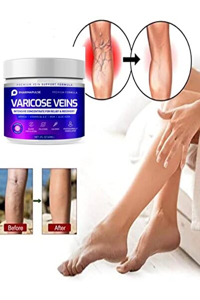 Afrodit Giyim Maximum Strength Varicose Vein Var.is Bacak Bakım Masaj Kremi 1...