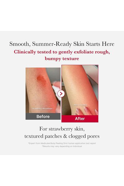 Medicube Red Exfoliating Body Spray for Acne 110g