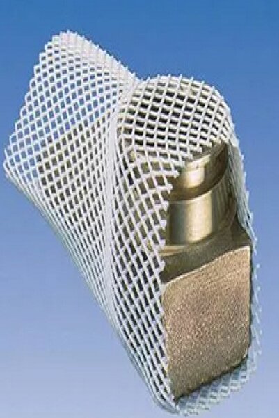 porporashop Metal Koruma Filesi, 1 cm-2 cm Kadar Genişler, 430 m, 10 Kg, Şeffaf