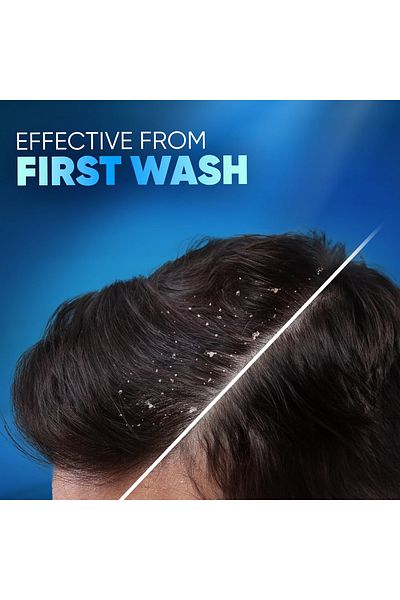 Head&Shoulders Head & Shoulders Deep Clean Flaky Scalp Sea Minerals Anti-Dandruff Shampoo 400 ml