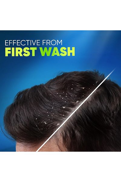 Head&Shoulders شامبو هيد آند شولدرز المضاد للقشرة برائحة الحمضيات لتنظيف عميق لفروة الرأس الدهنية 400 مل