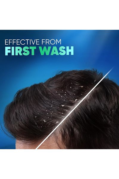 Head&Shoulders Head & Shoulders Deep Clean Itchy Scalp Peppermint Anti-Dandruff Shampoo 400 ml