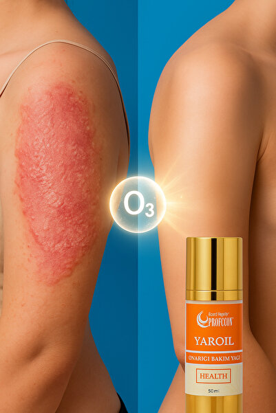 profozon Ozon Yağı ile Doğal Cilt Bakımı | , , Akne ve Leke Görünümüne Destek-Profozon Yaroil 50ml
