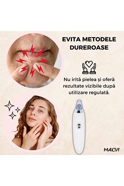 MACVI Macvi® Blackhead Vacuum with 2 speeds, 4 tips, extraction technology, White