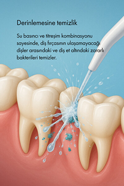 Whirtz Aile Boyu Ağız Duşu - 10 Kademe Atış Gücü, Uv Sterilizasyon, Diş Taşı Engelleme