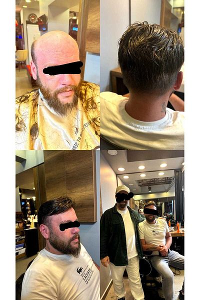 İNTERPROTEZ Prosthetic Hair Qa8 - 6X8 - Color Dark Chestnut Thin Wire All Directions Combable Bottom Structure 100% Human Hair
