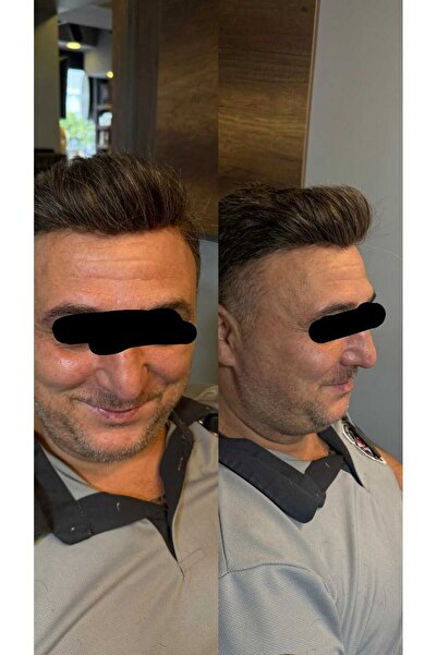 İNTERPROTEZ Protez Saç QA8 - 7x10 - Renk Koyu Kestane İnce Telli Her Yöne Tar...