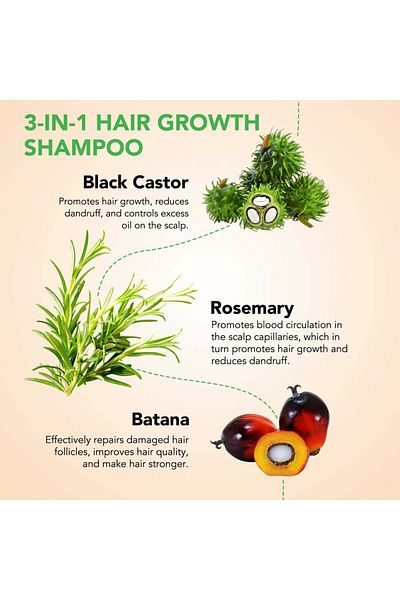 NOVA KISS 3 In 1 Shampoo With Rosemary Oil, Castor Oil, And Rosemary Oil For Hair Growth, ® 300 ml