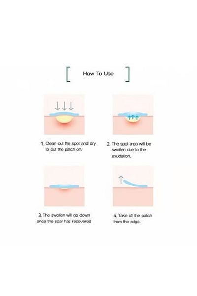 Some By Mi Some By Mi 30 Days Miracle Patches for Acne and Scars - 18 Patches