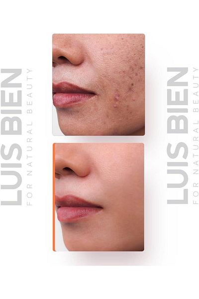 Luis Bien Luis Bien Cream with Vitamin B3 Glycerin and Alpha Arbutin with pigment spot correction effect, 50 g