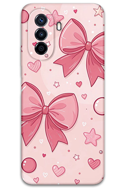 Gramaphone Huawei Nova Y70 Uyumlu Kurdele Desenli Telefon Kılıfı + Ekran Koruyucu - 5803