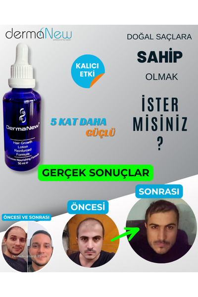 Dermanel Saç Losyonu Saç uzatıcı - Saç Gürleştirici Serum - Saç çıkarıcı serum / 10 Adet Serum Şampuan Roller