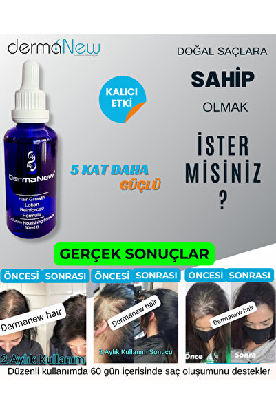 Dermanel Saç Losyonu Saç uzatıcı - Saç Gürleştirici Serum - Saç çıkarıcı serum / 10 Adet Serum Şampuan Roller