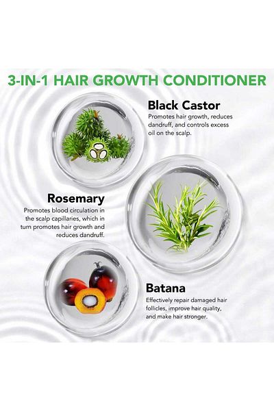NOVA KISS 3 in 1 Hair Conditioner with Rosemary, Castor and Rosemary Oil for Hair Growth, NOVA KISS® 300 ml