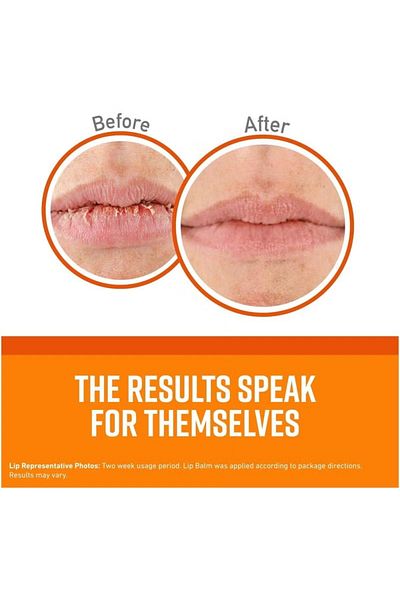 O'Keeffe's OKeeffes Unscented Lip Repair Balm - 4.2g