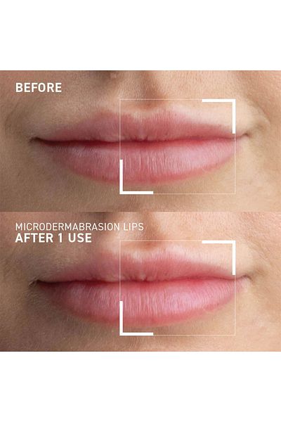 Dr. Brandt Smoothing Lip Scrub Lip Scrub