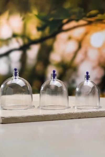 CİYU TİCARET 100 Adet 6 numara hacamat kupası 100'lü paket hacamat kupa 6 num...