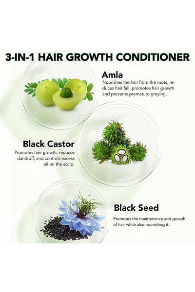 NOVA KISS 3 in 1 Hair Conditioner with Castor Oil, Amla, Black Seed for Hair Growth, 300 ml