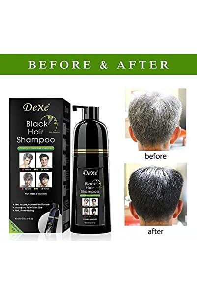 Dexe Instant Black Hair Shampoo for Gray Coverage 400ml - Instant Coloring in 5 Minutes Lasting 90 D