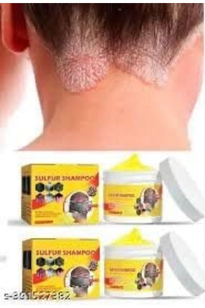 South Moon Sulphur Shampoo for Bacteriostasis, Itching Relief, Reduces Tinea Capitis, Restores Moist