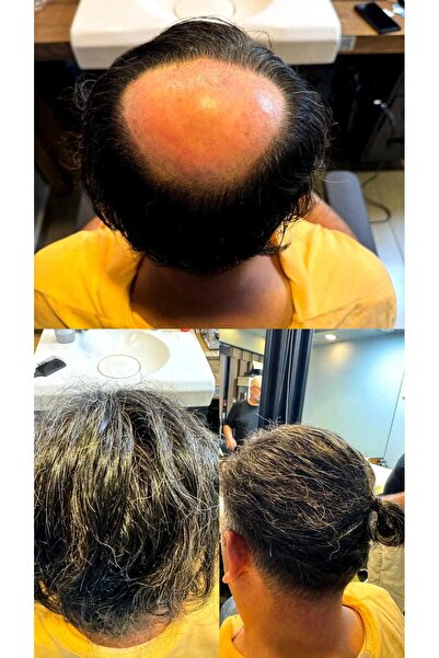 İNTERPROTEZ Protez Saç QA8 - 6x10 - Renk Koyu Kestane İnce Telli Her Yöne Tar...