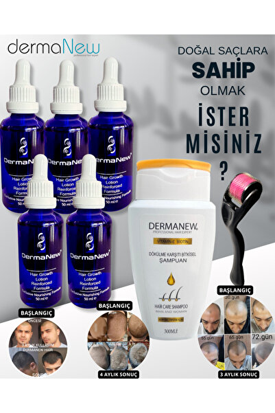 dermanew Saç Losyonu Saç Bakım Yağı - saç gürleştirici - saç yağı lotion / 5 ...