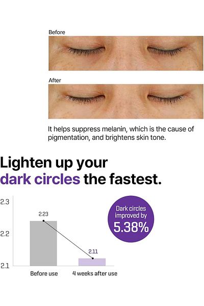 Some By Mi Retinol Intense Advanced Triple Action Eye Cream | 30ml | Mild Overnight Korean Anti