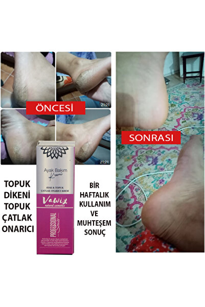 Vawix Topuk Dikeni Ve Topuk Çatlakları Için Ayak Bakım Kremi - 100 Ml.
