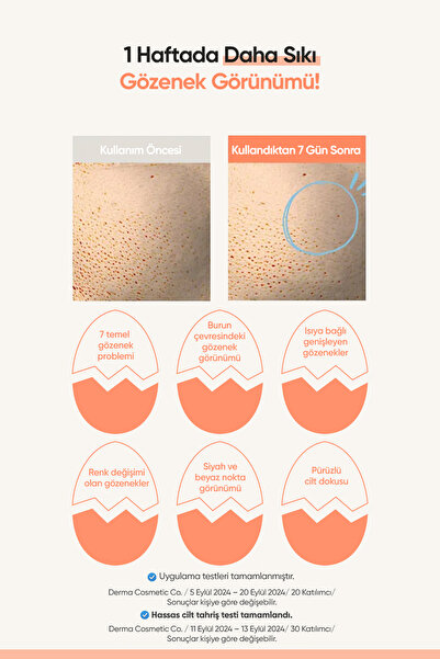 Missha Cilde Aydınlık ve Pürüzsüz Görünüm Kazandıran Gözenek Karşıtı Krem A'PIEU Egg Pha Pore Cream