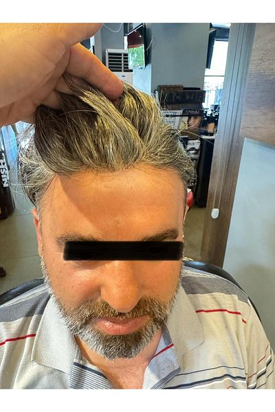 İNTERPROTEZ Prosthetic Hair New Austria - 6X9 - Color Grey Fine Wire All Directional Weave Substructure 100% Human Hair