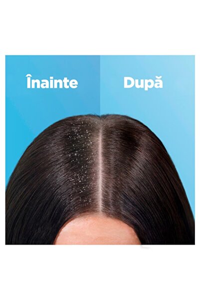 Head&Shoulders Ocean Fresh Anti-Dandruff Shampoo, 330 ml