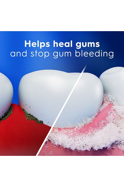 CREST Toothpaste, Crest, Pro-Health, Gum Detoxify, Gentle Whitening, Helps Whiten Teeth and Protect Gums