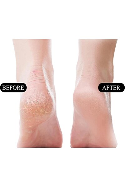 QUEENVİP Paslanmaz Çelik Çift Taraflı Topuk Törpüsü/Topuk Rendesi