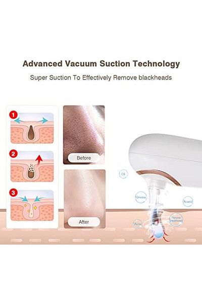 KINSEI BEAUTY KinseiBeauty Electric Blackhead Remover Vacuum